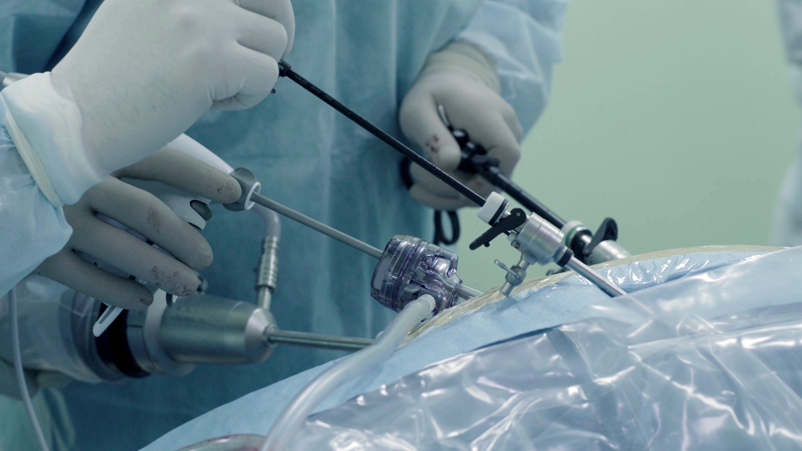 Laparoscopic surgery of the abdomen